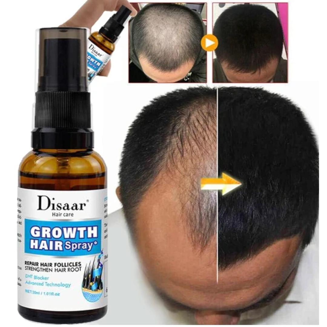 Hair Growth Spray - 30 ml