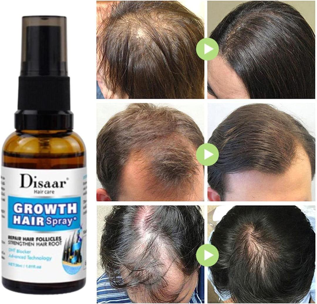 Hair Growth Spray - 30 ml