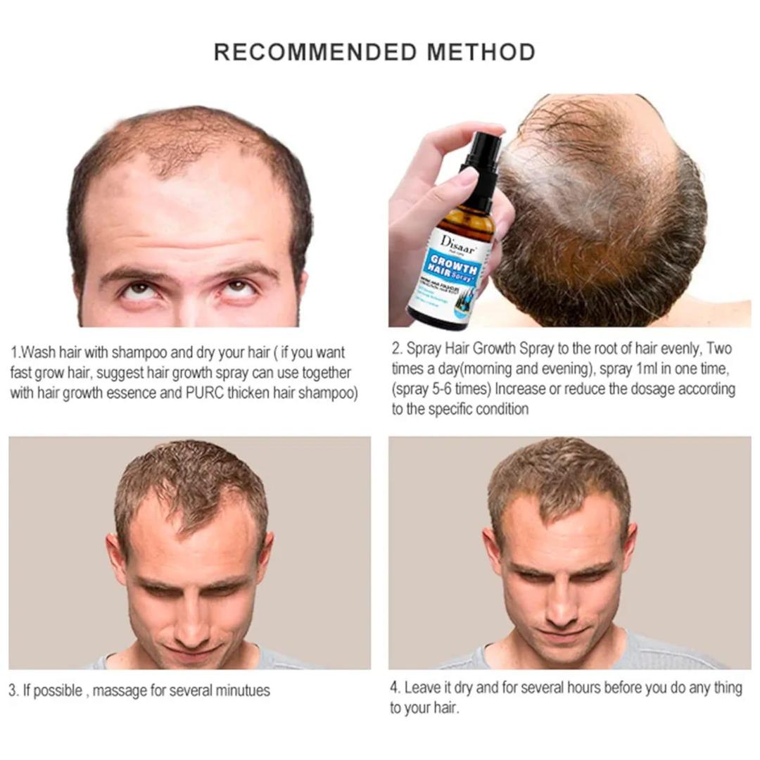 Growth Hair Oil Spray - Image 6